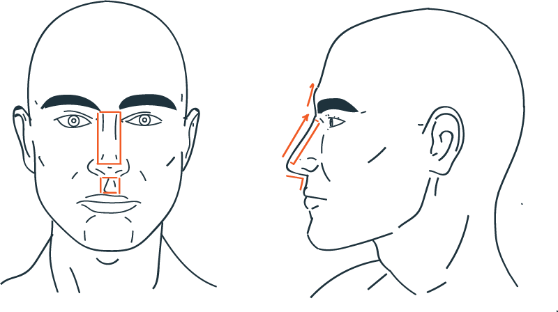 Male nose rhinoplasty